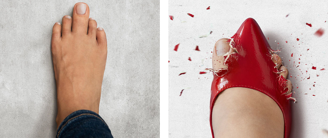 špičaté lodičky ignorují tvar vašich chodidel