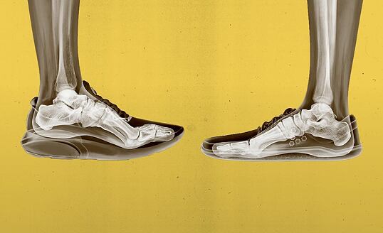 Má obuv vplyv na naše zdravie?