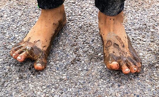 Výhody a nevýhody barefoot obuvi